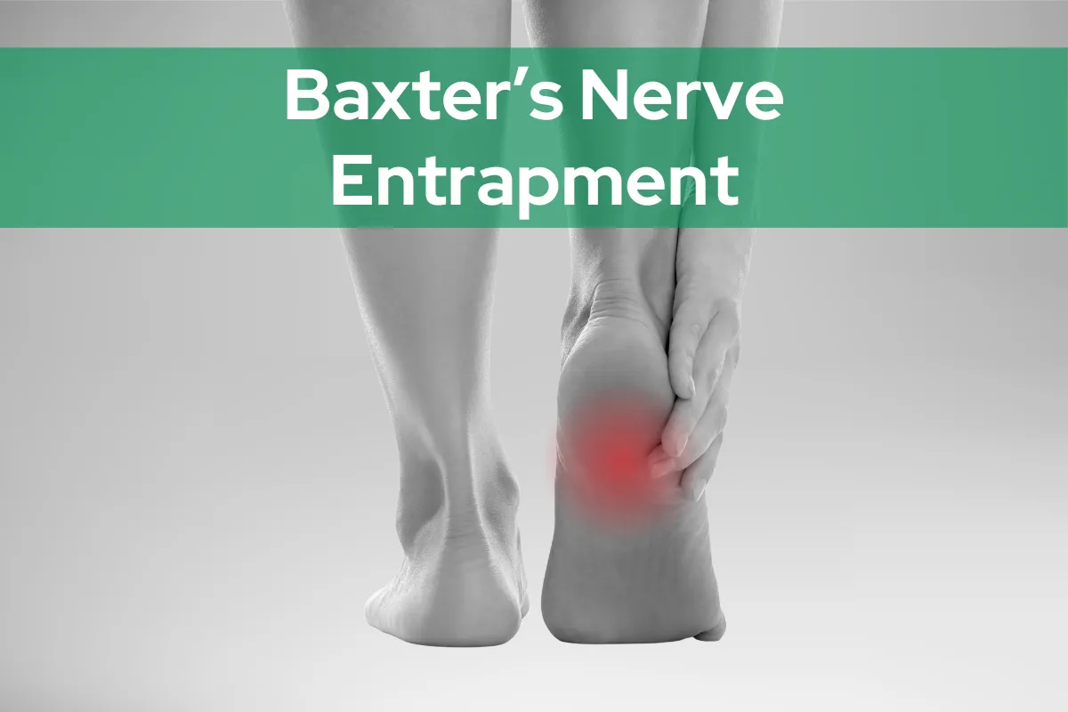 Baxter’s Nerve Entrapment