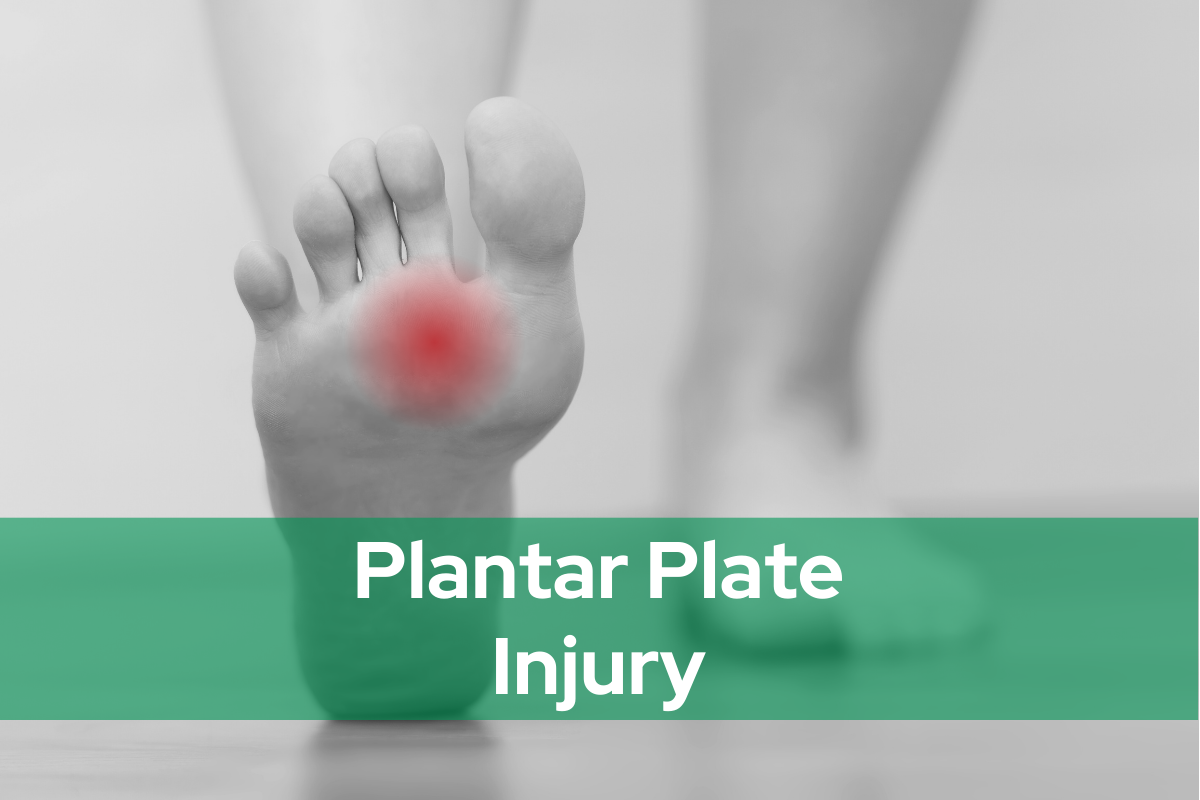 Plantar Plate Injury