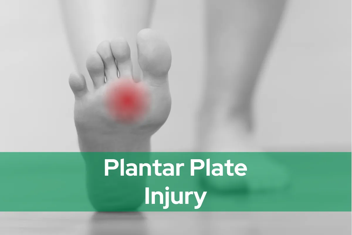 Plantar Plate Injury
