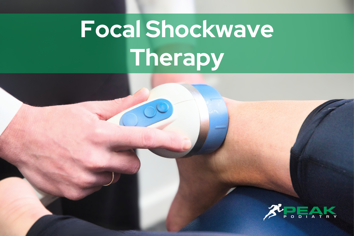 How does shockwave work?