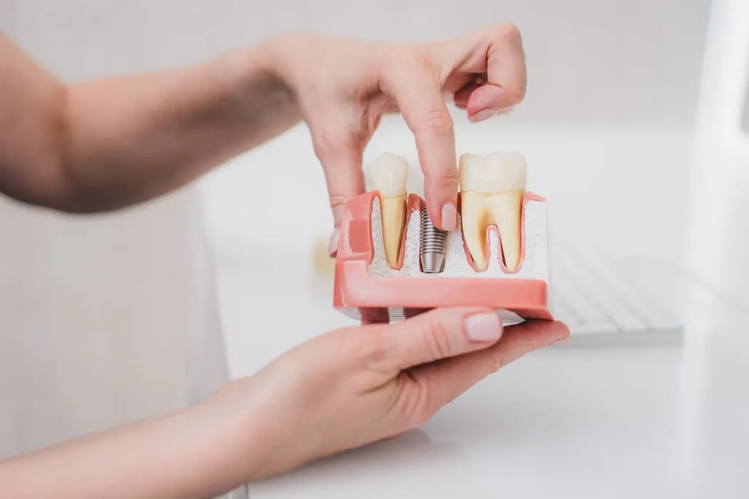 implanty-zebow-krakow