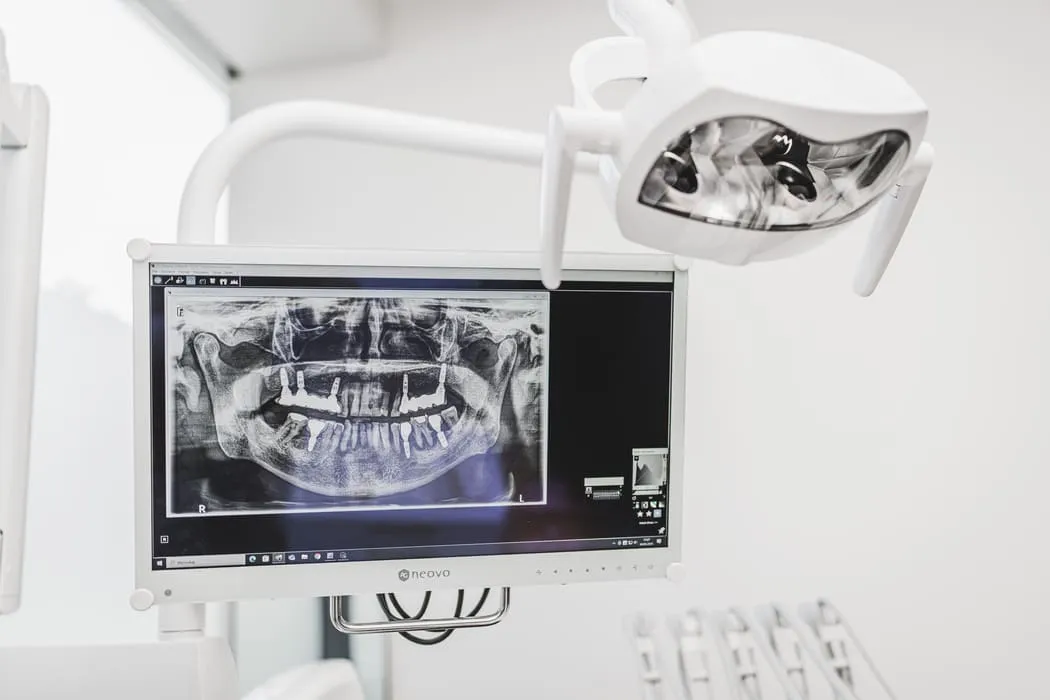 mosty-protetyczne-na-implantach