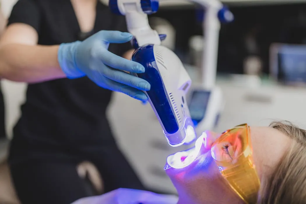 wybielanie-zebow-gabinetowe