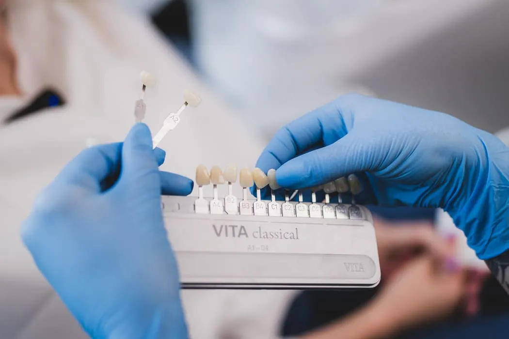 wybielanie-zebow-krakow-stomatologia-wichlinscy