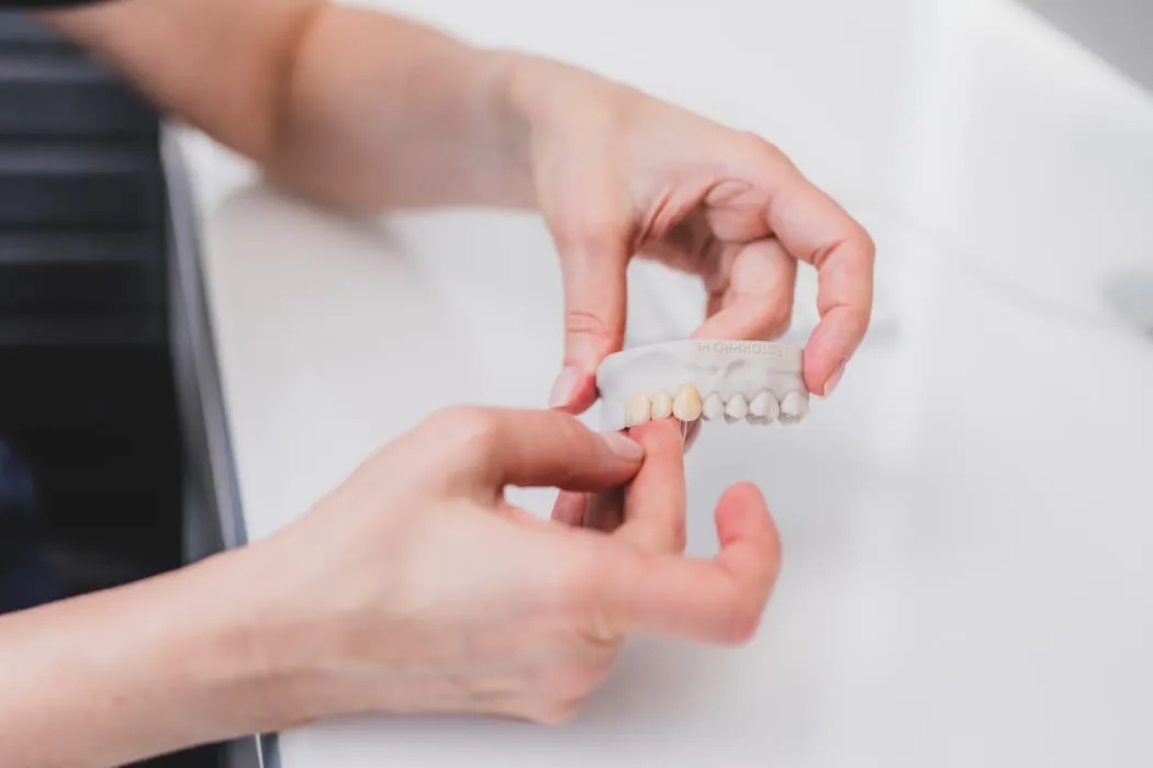 koronki-na-zeby-krakow