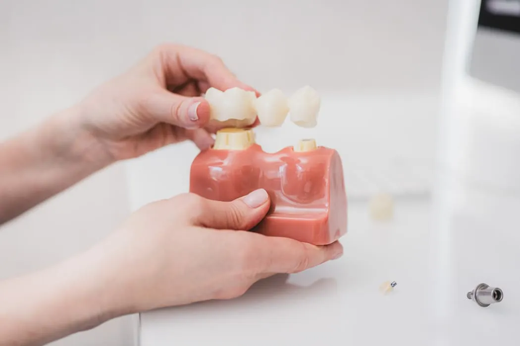 most-na-implantach-krakow