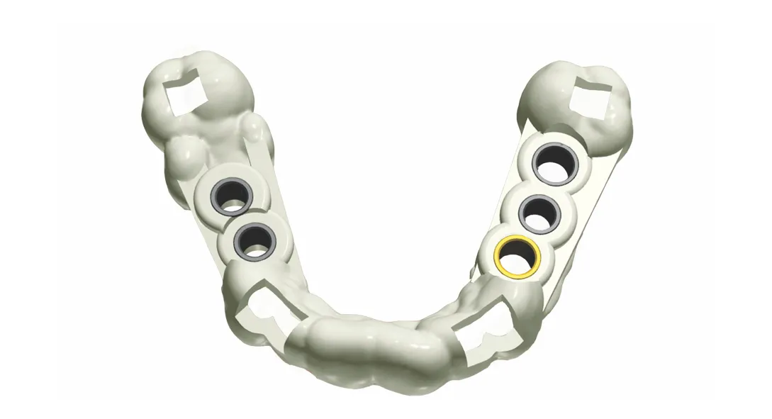 IS-2017-Guide02NoGingiva