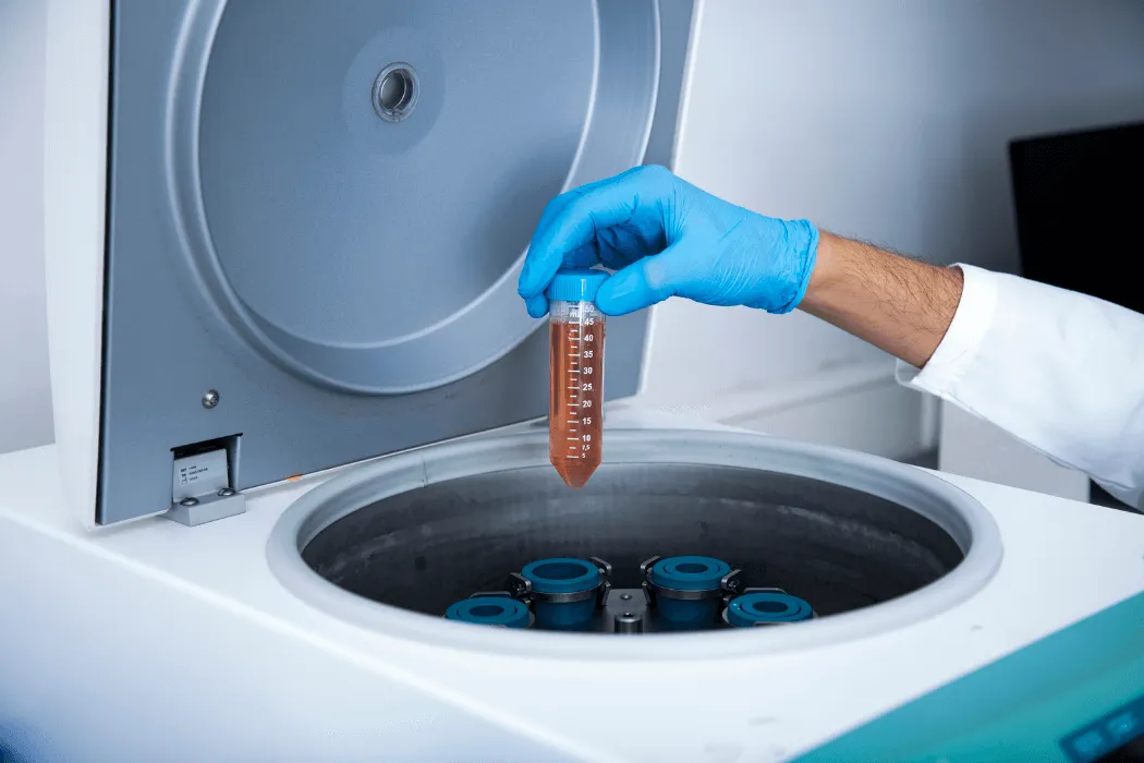 fibryna-bogatoplytkowa-stomatologia-wichlinscy