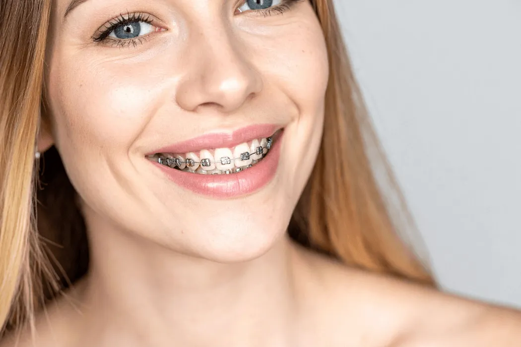 korekta-zgryzu-ortodonta-w-pracy-stomatologia-wichlinscy