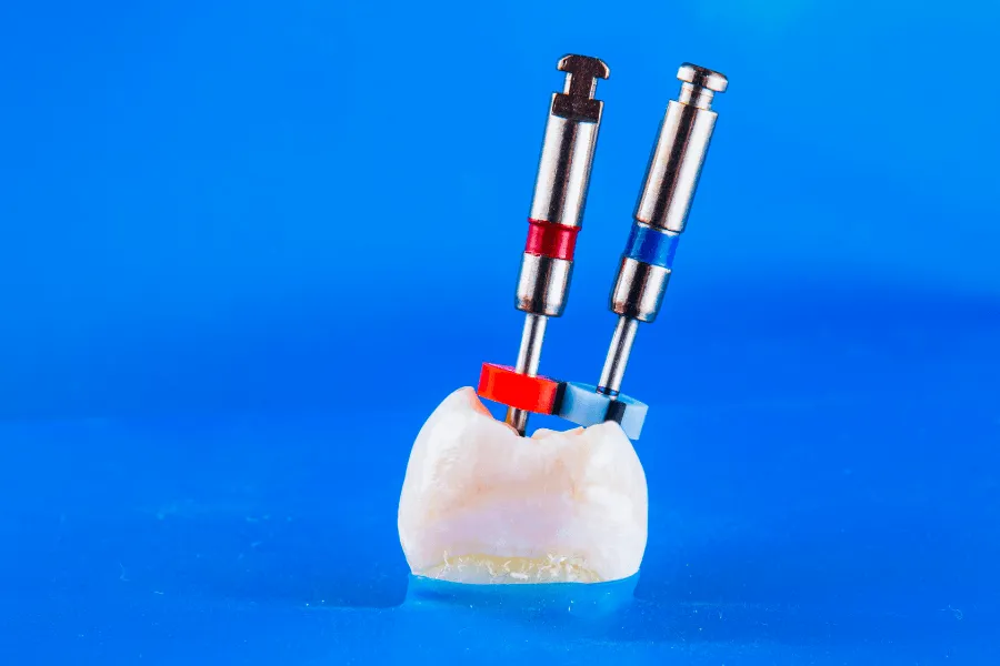 ryzyko-powiklan-po-endodoncji