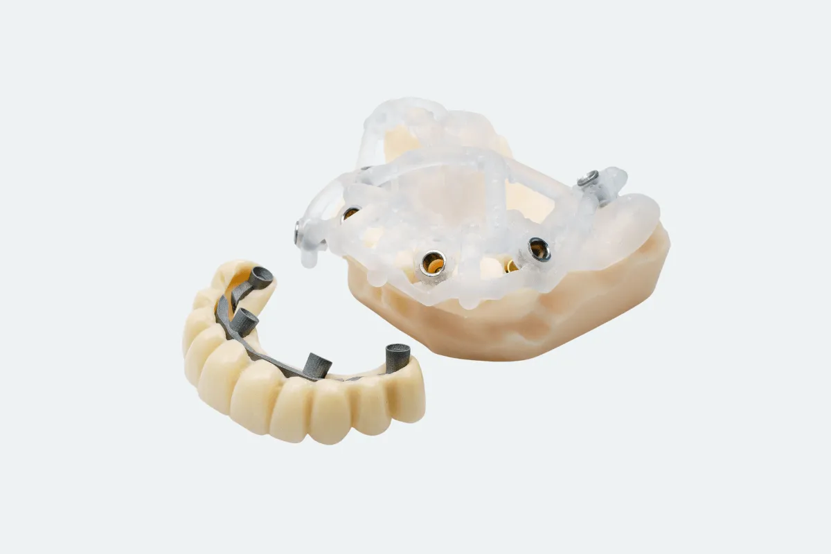all-on-x-uklad-zebow-proteza-model