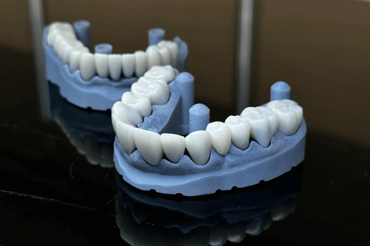 pelny-luk-zebowy-na-implantach