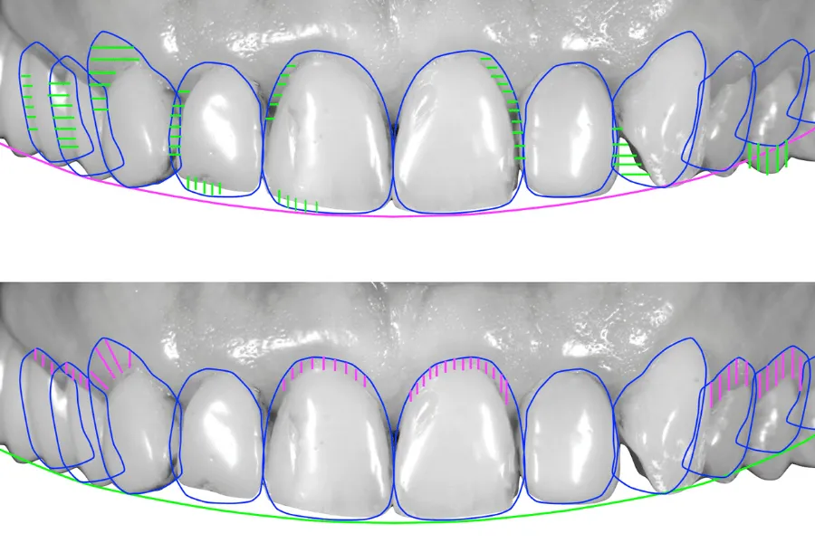 digital-smile-design-stomatologia-wichlinscy