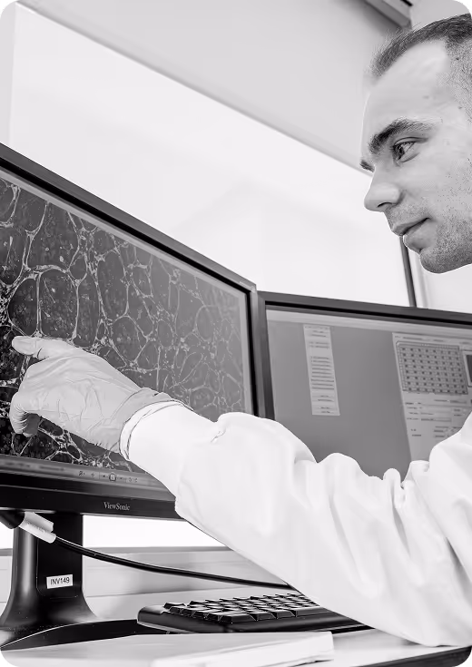 Medical professional analyzing brain scan on computer monitor