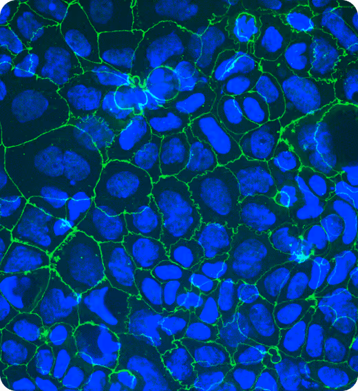 Microscopic view of blue cells with green cellular network boundaries
