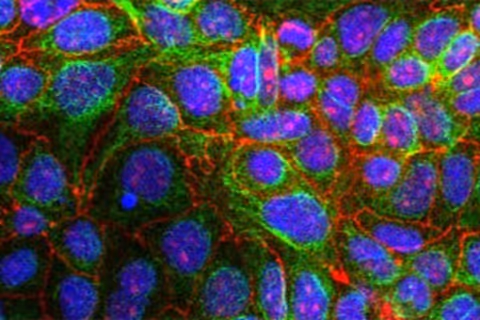 Colorful microscopic view of cells with blue nuclei and green-red networks
