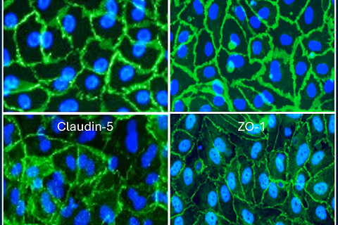 Microscope images of cells with blue nuclei and green cell junction proteins