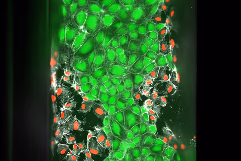 Microscopic view of green cells with red-highlighted cellular structures