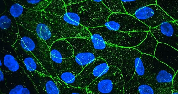 Microscopic view of blue nuclei connected by green neural networks