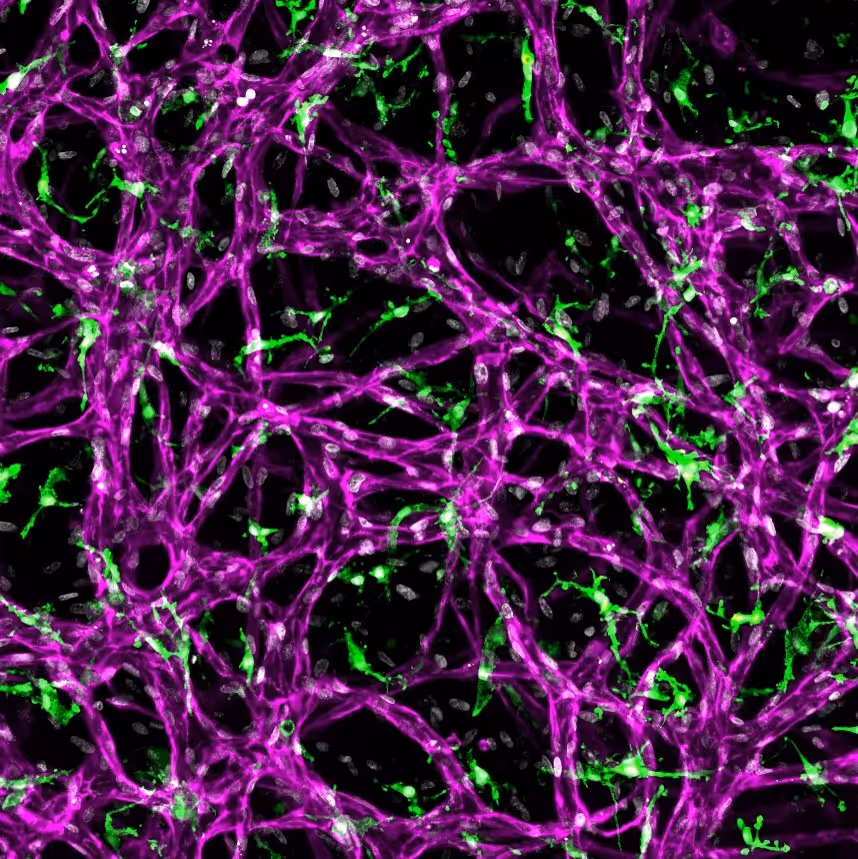 Microscopic view of intertwined purple and green neural network cells