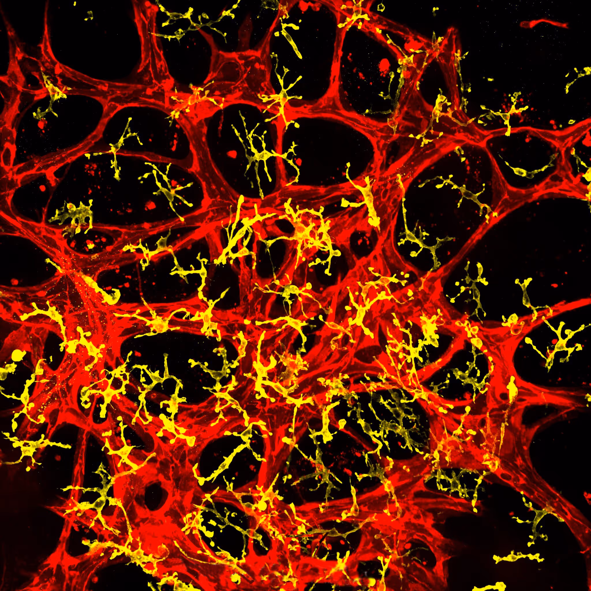 Microscopic view of interconnected red and yellow cellular network