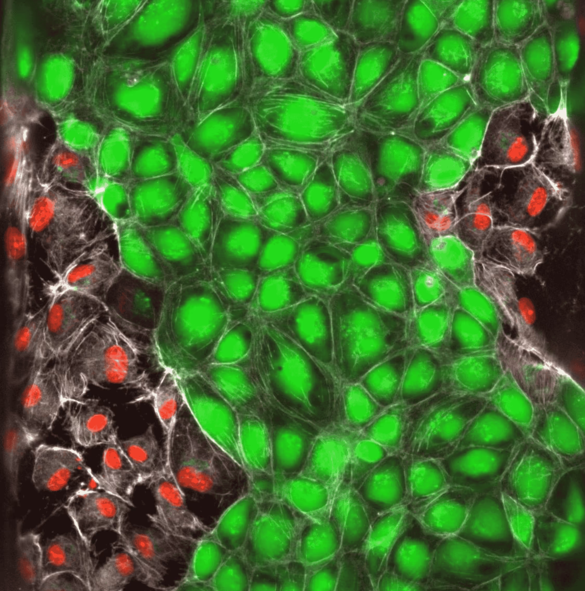 Fluorescence microscopy of cells with green nuclei and red cellular structures