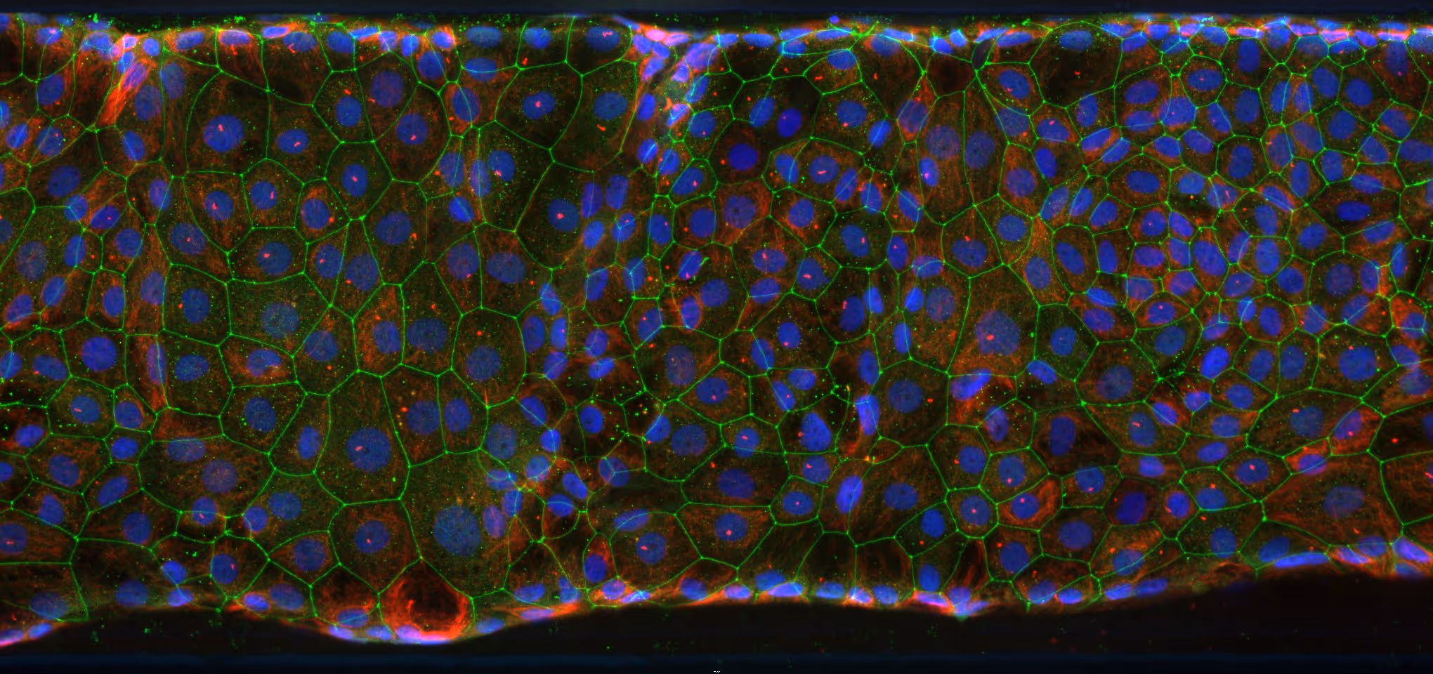 Colorful microscopic view of cells with blue nuclei and green cell boundaries