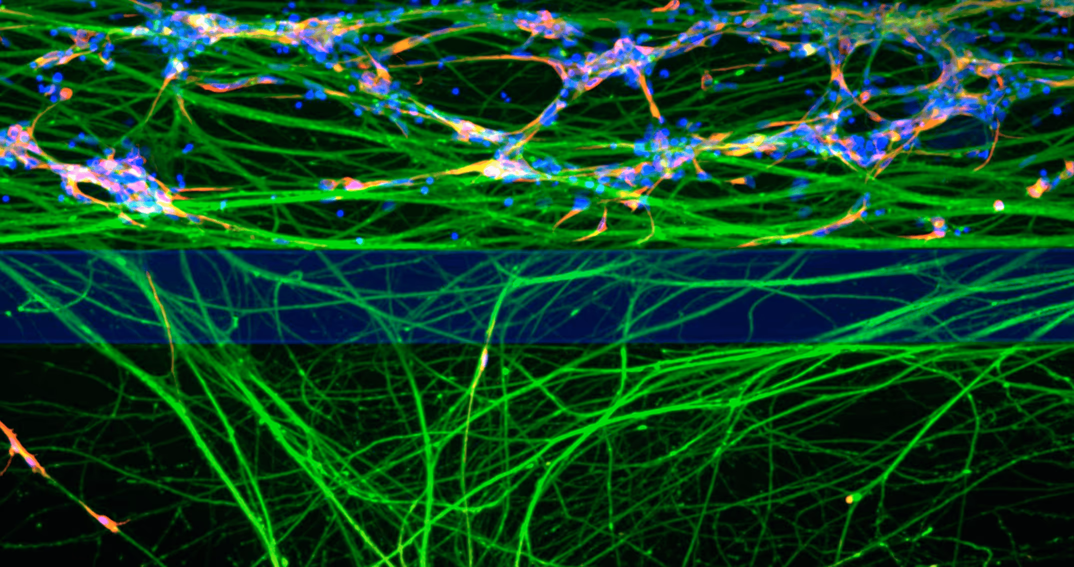 Microscopic neural network with intricate green, blue, and orange connections