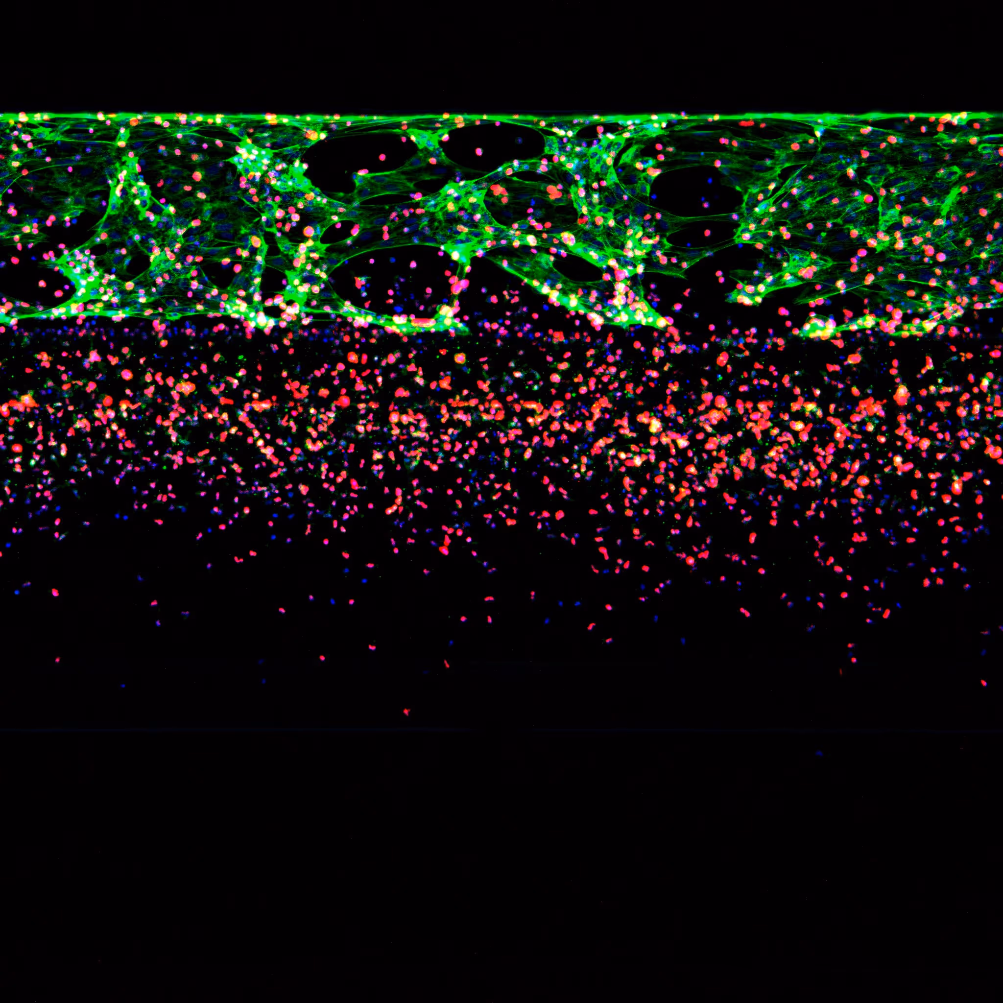 Fluorescent microscopy image of cellular structures in green and red