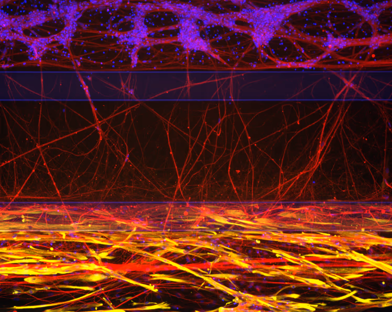 Microscopic view of tangled neurons with vibrant red, yellow, and blue colors