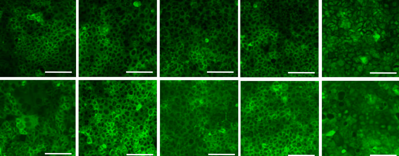 Green fluorescent microscopy images showing cellular structures and protein localization