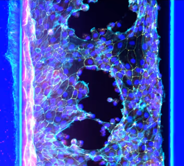 Microscopic view of cells with blue and purple fluorescent staining