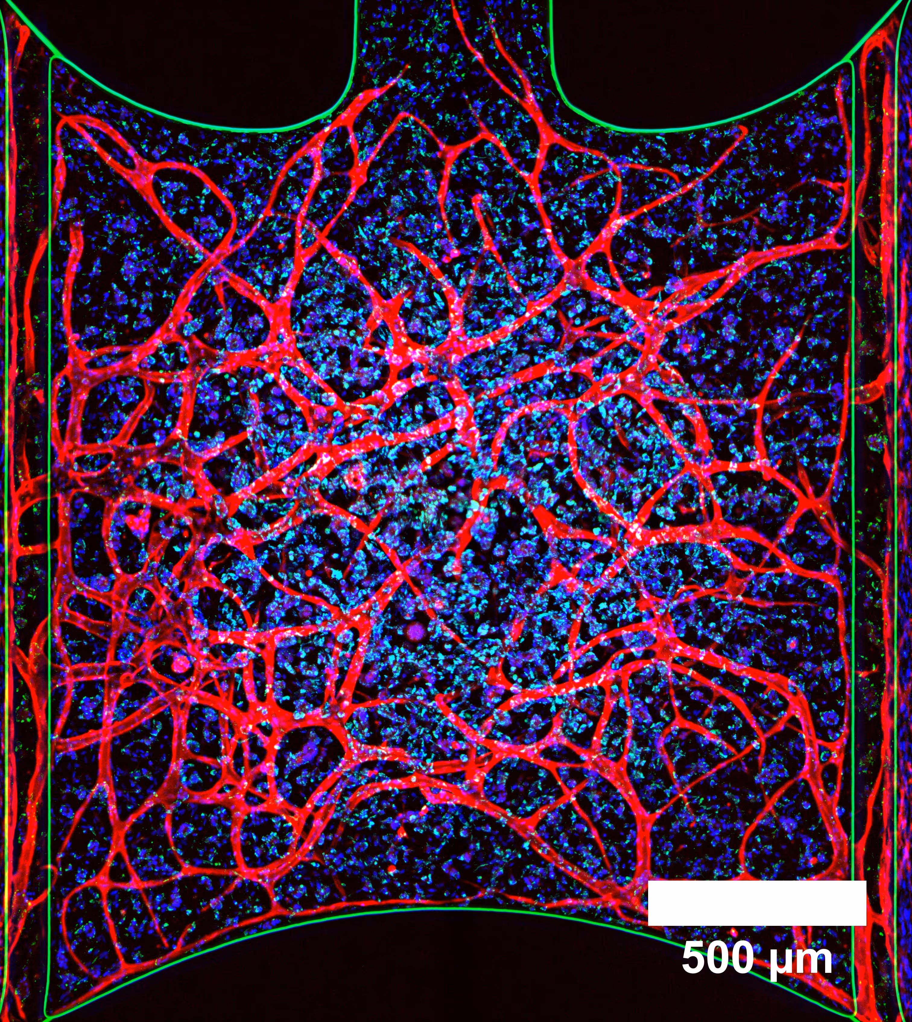 Microscopic view of intricate red blood vessel network on blue background