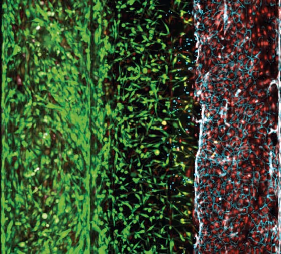 Microscopic cellular image with green, black, and red color gradient