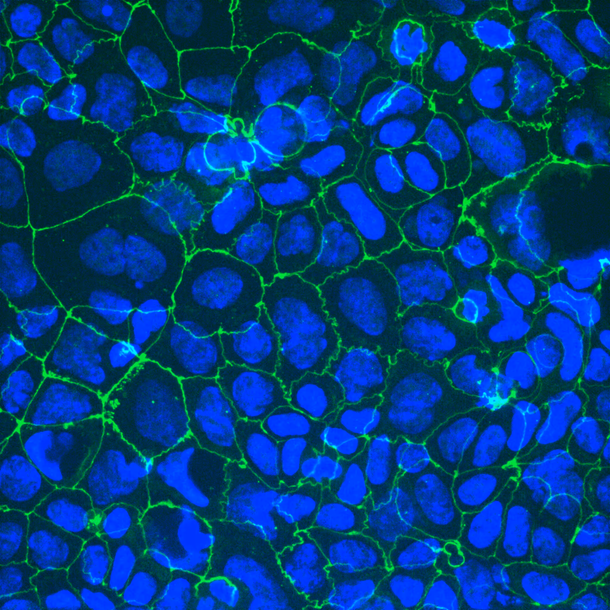 Microscopic view of blue cells with green cellular boundaries and nuclei