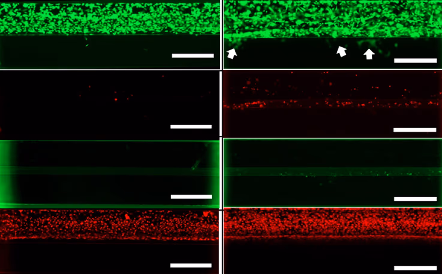 Fluorescence microscopy images with green and red cellular protein staining