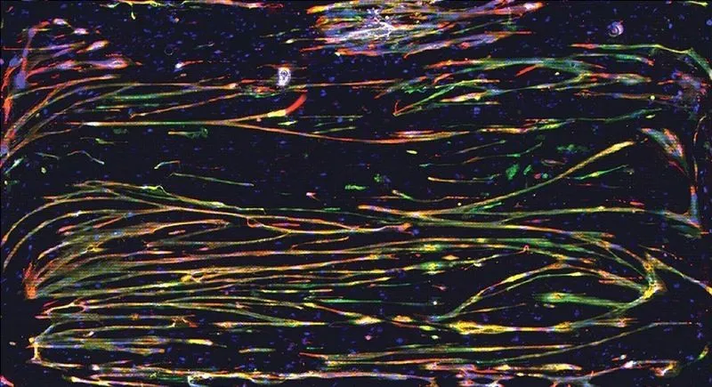 Courtesy of Dr. Marta K. Lewandowska, Uppsala University, Sweden