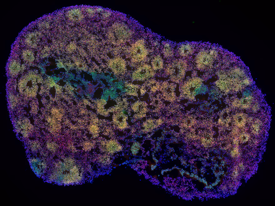Courtesy of Dr. Michele Bertacchi, Institute of Biology Valrose, (iBV), France