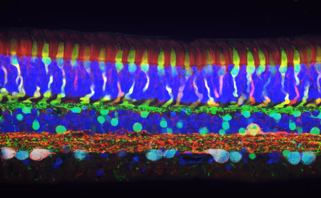 Courtesy of Dr. Annalisa Bucci, Institute of Molecular and Clinical Ophthalmology Basel (IOB)