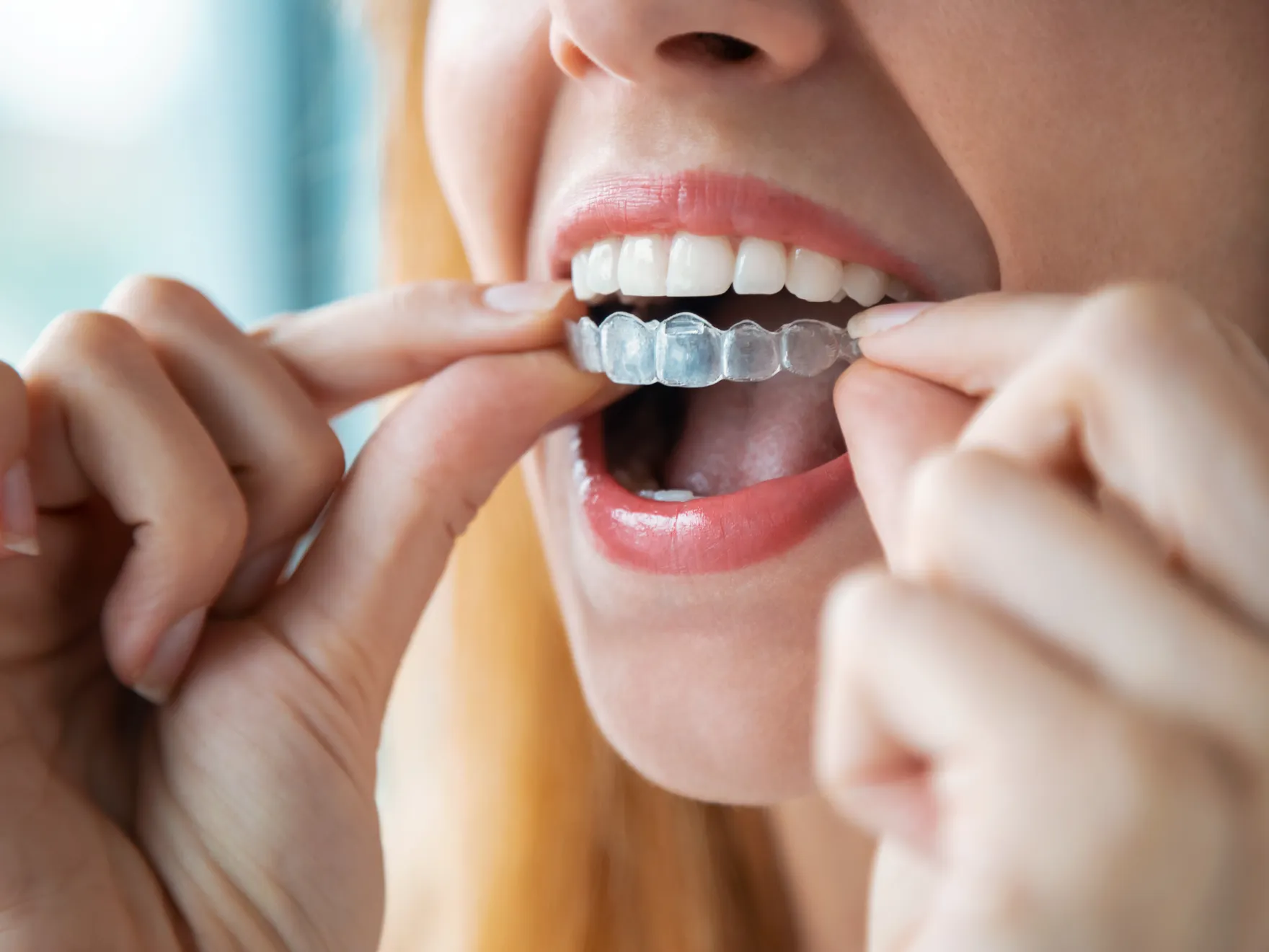 woman with braces on her teeth brushing her teeth with a toothbrush  Dynamic Dental
