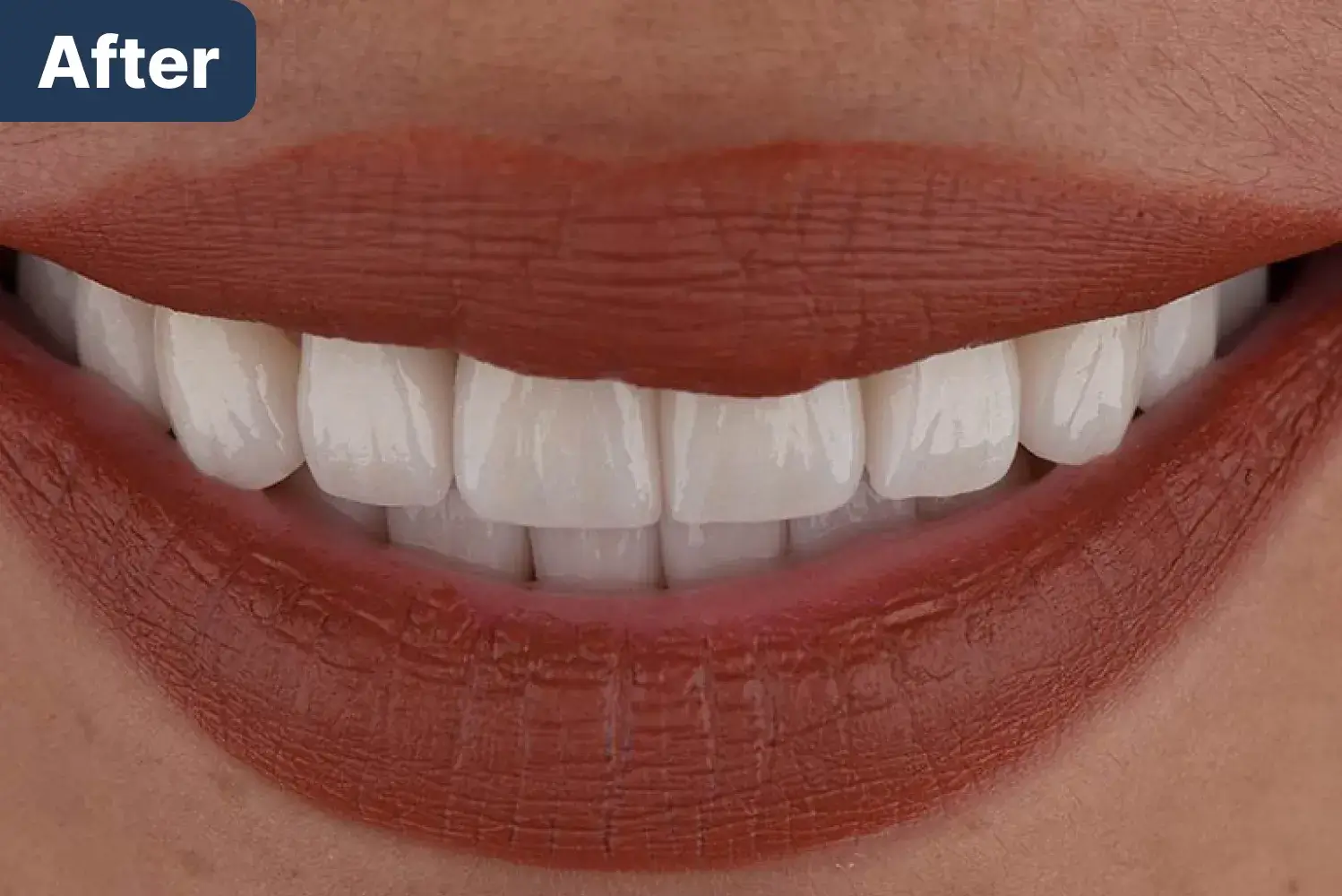 after Dynamic Dental