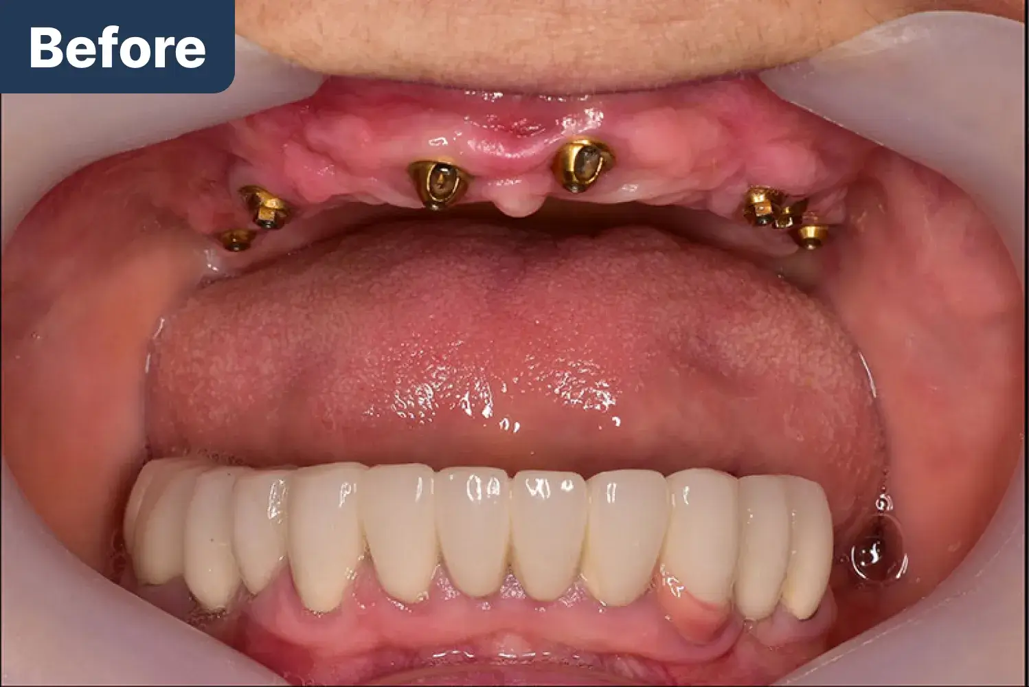 before Dynamic Dental