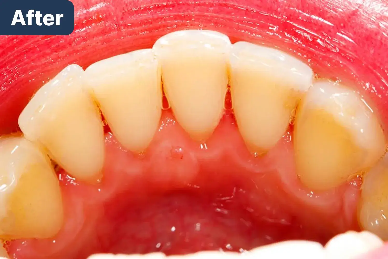 After Dynamic Dental