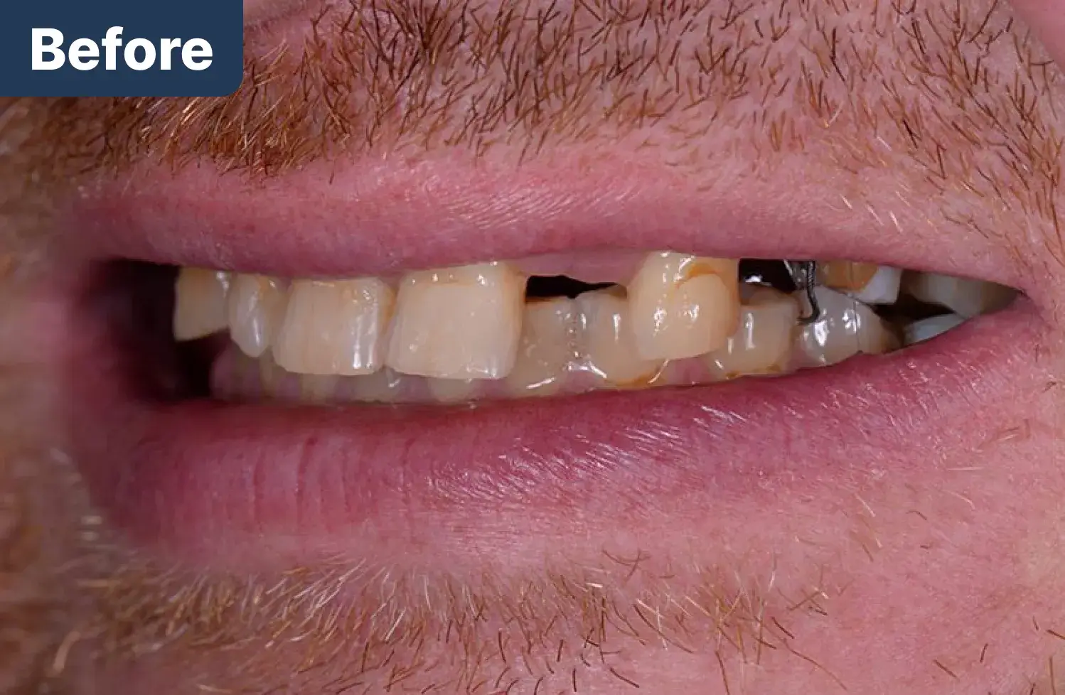Before Dynamic Dental