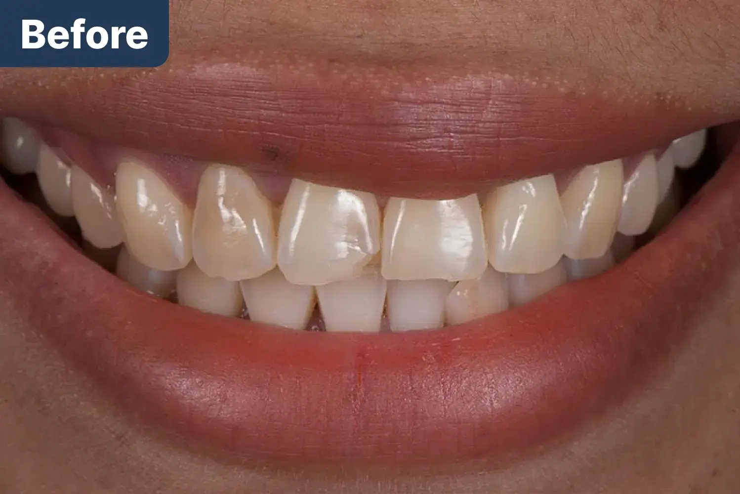 before Dynamic Dental