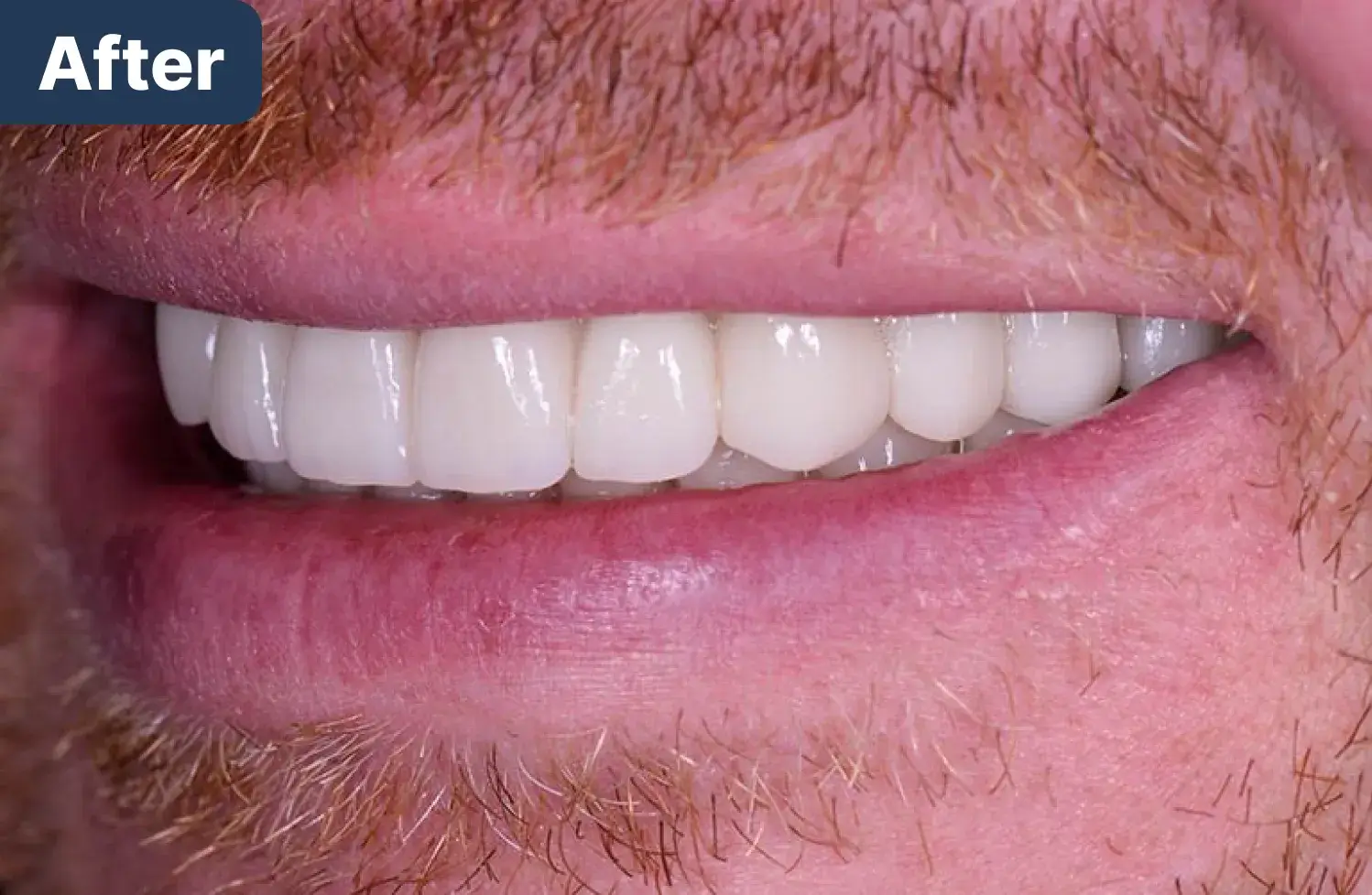 after Dynamic Dental