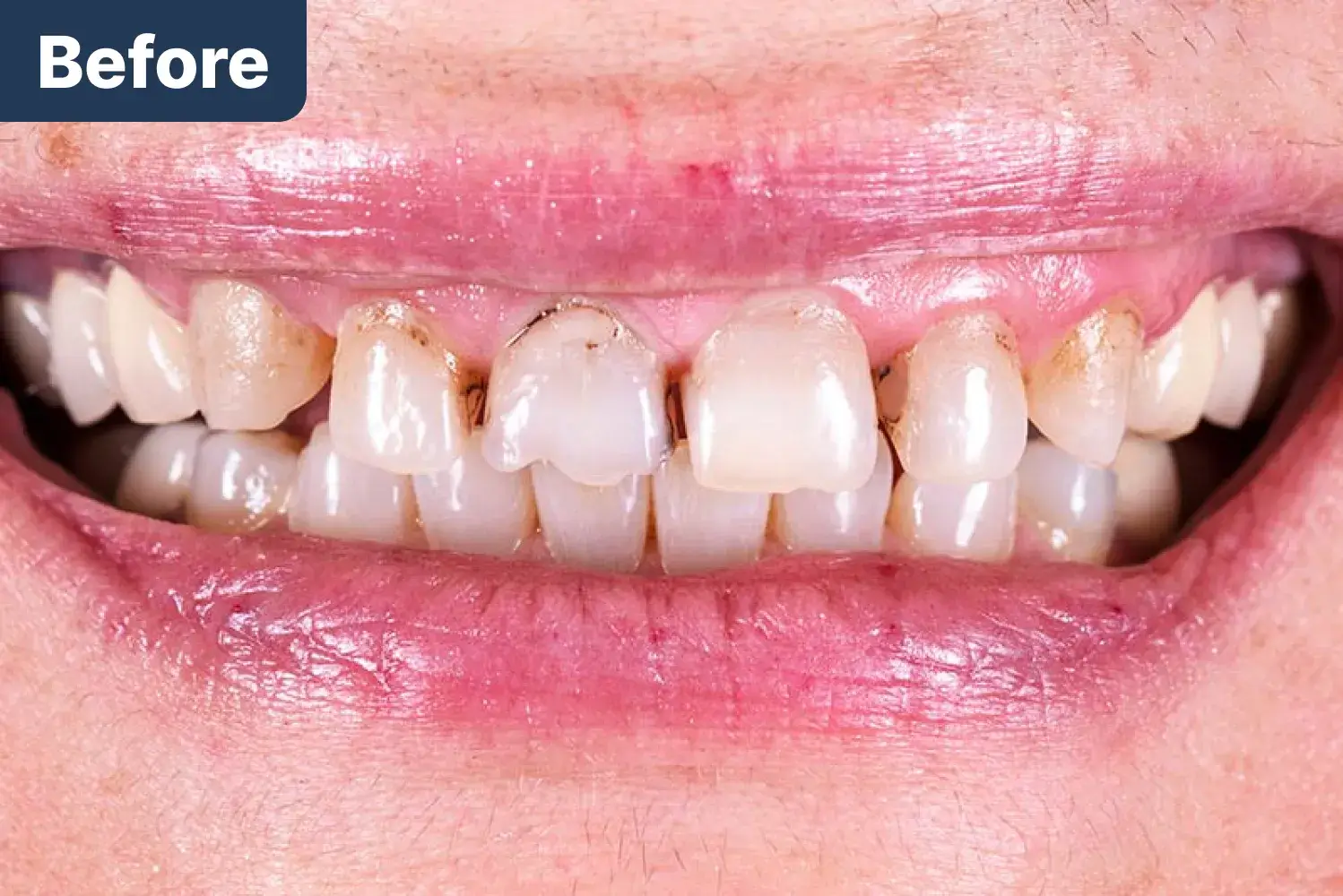 Before Dynamic Dental