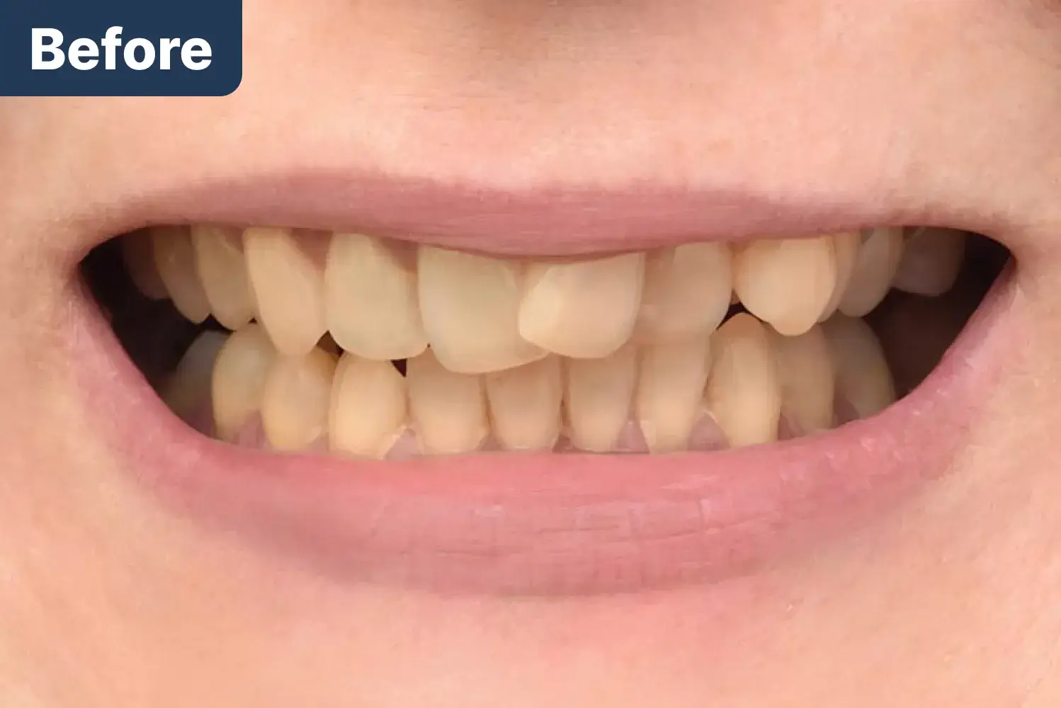 Before Dynamic Dental