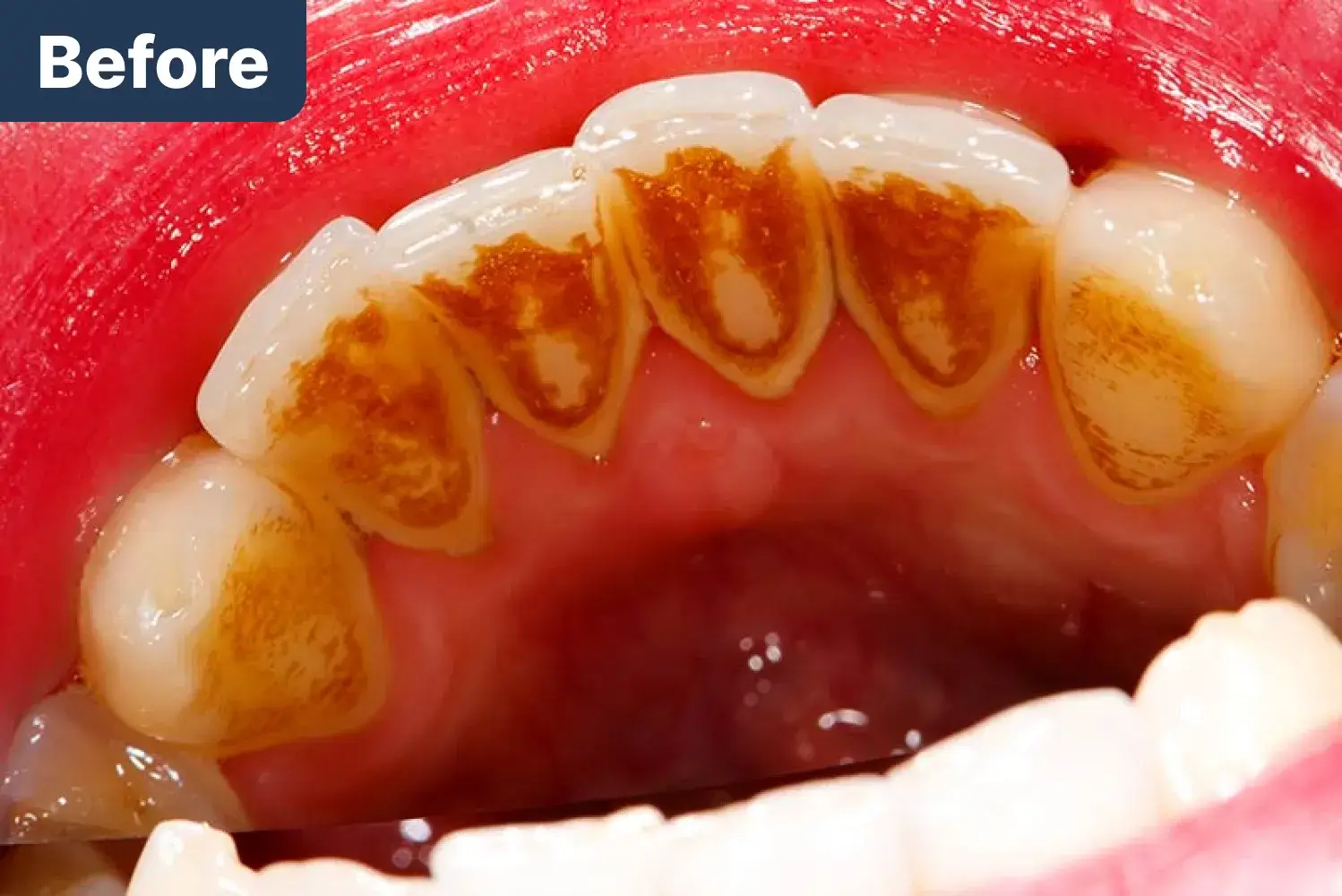 Before Dynamic Dental