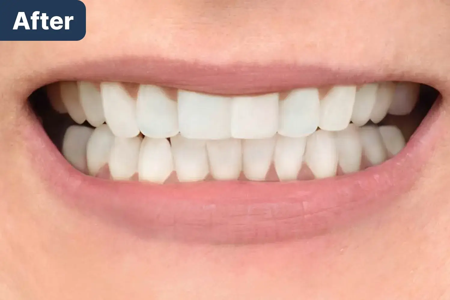 After Dynamic Dental